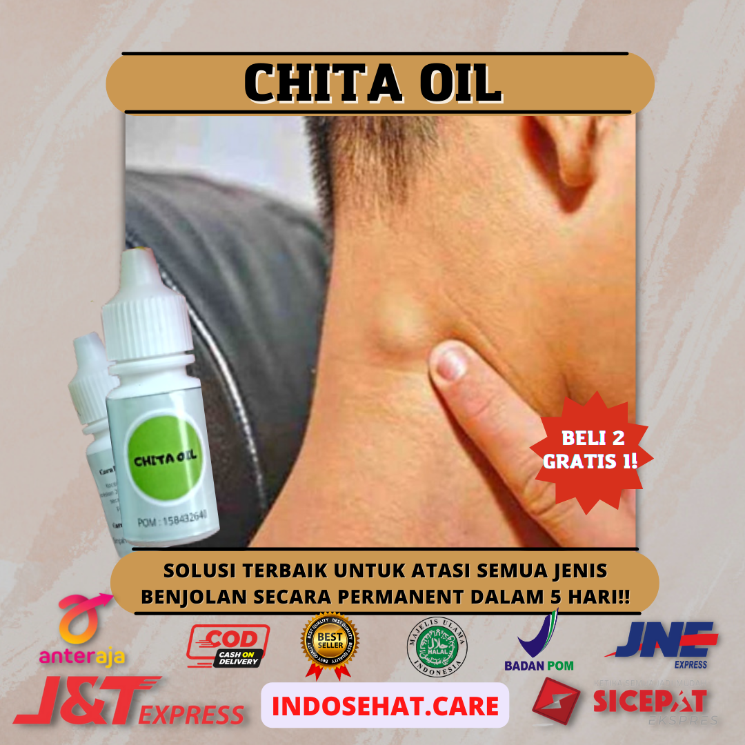 CHITA OIL Solusi Atasi Benjolan Dan Hilangkan Bekas Luka Secara