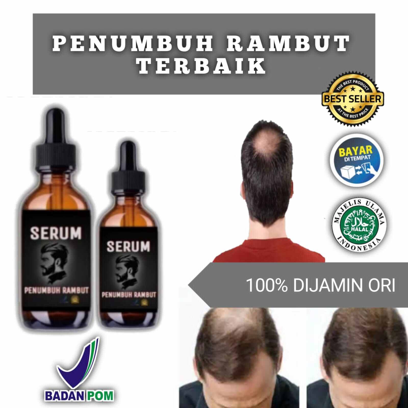 PROMO!! DISKON 15% OBAT BOTAK SERUM PENUMBUH RAMBUT RONTOK WANITA DAN ...