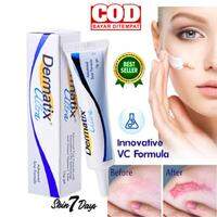 DERMATIX ULTRA GEL PENGHILANG BEKAS LUKA KELOID ANTI SCAR STRETCHMARK