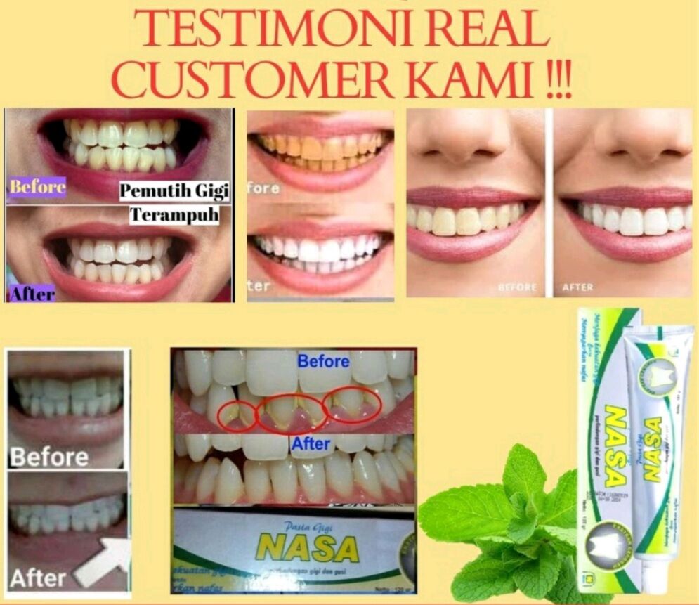 PASTA GIGI UNTUK SAKIT GIGI NASA ORIGINAL 100 NASA GIGI BERLUBANG DAN