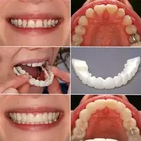 ORIGINAL Gigi Palsu Snap On Smile Bisa di bntuk sesuai ukuran Gigi kita full set atas Bawah