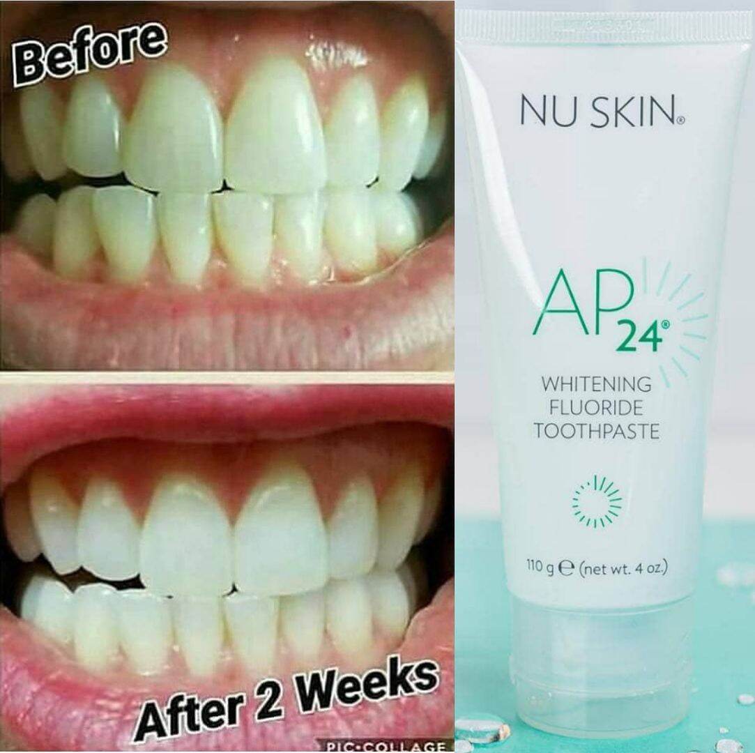 nuskin teeth whitening