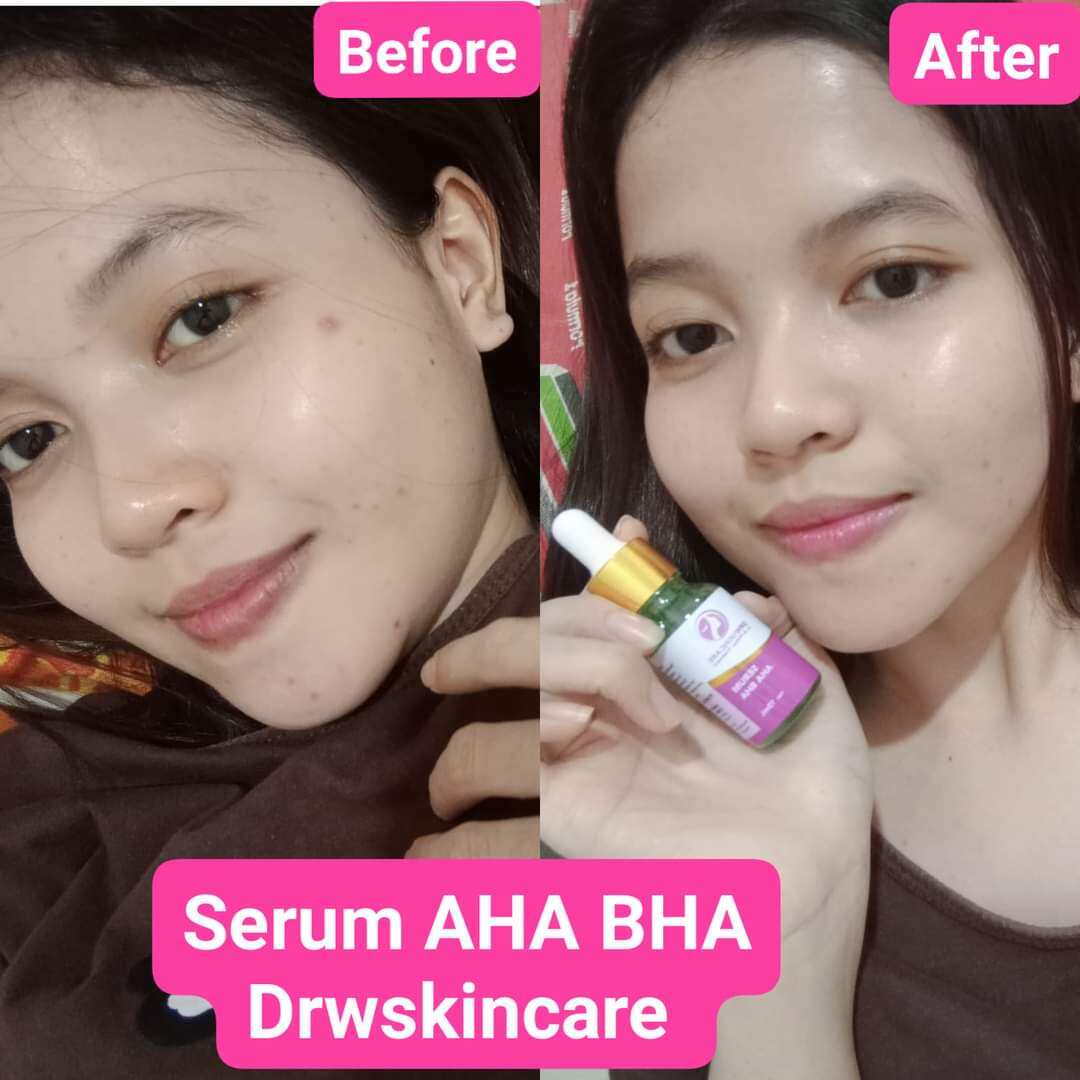Serum Aha Bha DRW Skincare | Lazada Indonesia