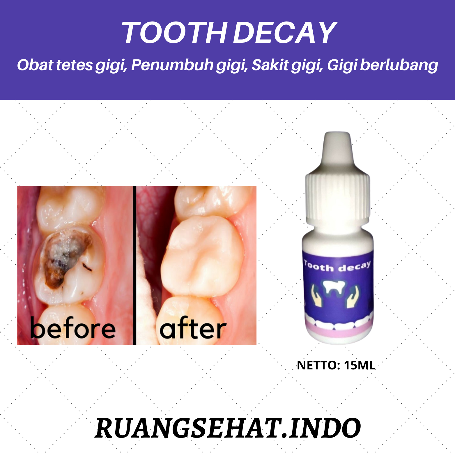 PENUMBUH GIGI 100 AMPUH, OMPONG, KROPOS, BERLUBANG, PATAH, SEMUA BISA