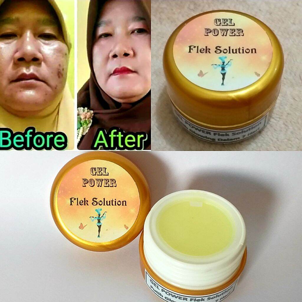 Krim wajah whitening flek Gel power krim malam flek hitam membandel paling ampuh