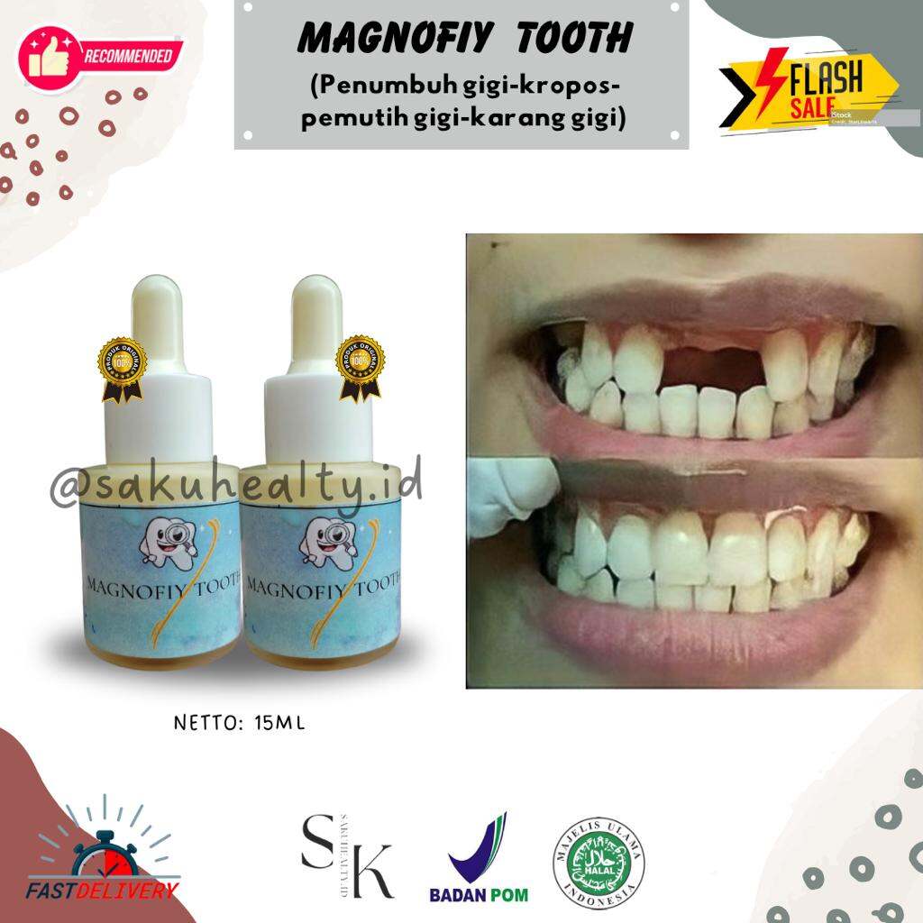 (MAGNOFIY TOOTH) PENUMBUH GIGI LANGSUNG TUMBUH/ GIGI PATAH,OMPONG