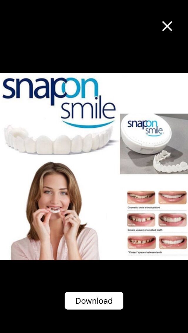 Jual Snap On Smile Authentic Terbaru Lazada Co Id
