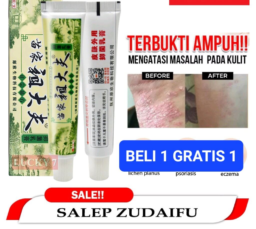 COD ISI 2 PCS ZUDAIFU SALEP ANTI BAKTERI ORIGINAL / Eksim, Gatal, Kurap ...