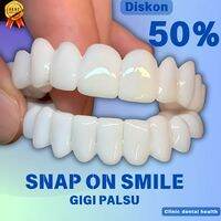 GIGI PALSU SNAP ON SMILE VINER GIGI ATAS BAWAH ORIGINAL 100 % 100% original top and bottom teeth smile Viner snap on dentures