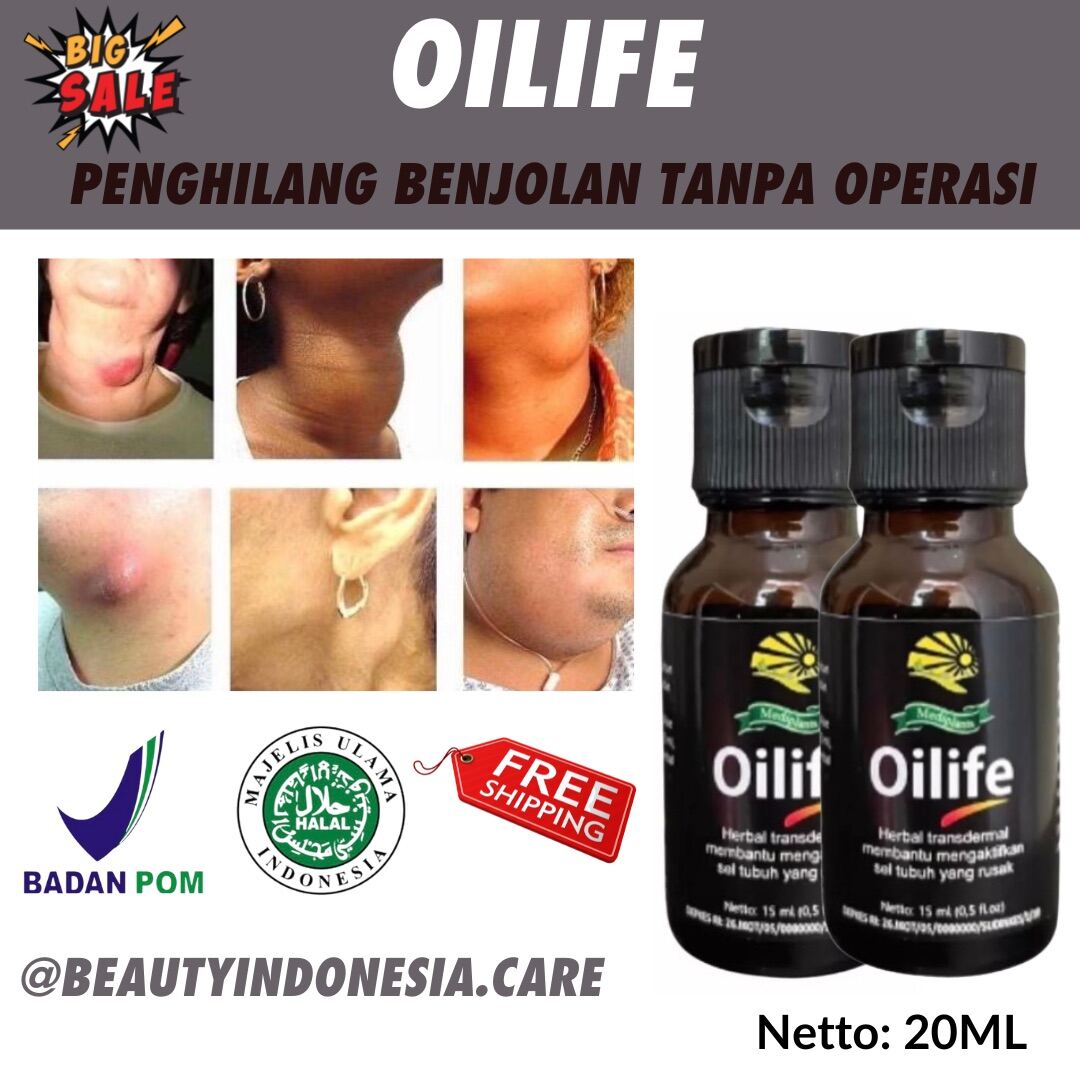 Benjolan Hari Langsung Hilang Oilife Minyak Oles Untuk Benjolan Obat Benjolan Benjolan