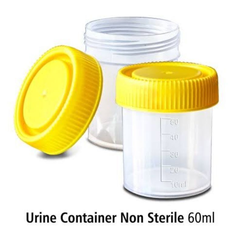 Urine Container Non Steril 60ml Onemed Pot Urine Wadah Sampel Urin ...