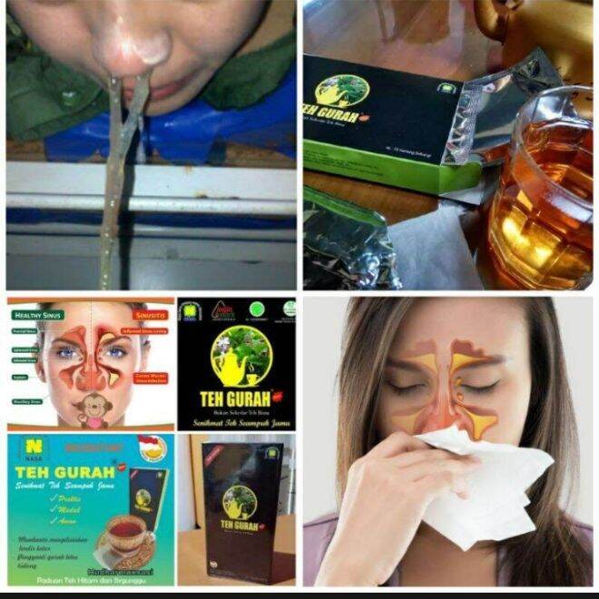 Teh Gurah Penghilang Lendir Dan Dahak Tenggorokangurah Herbal Obat Batuk Berdahak Lazada 9036